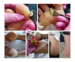 Curso Plástica nos Pés - 2