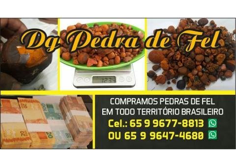 Pedra de vesícula bovina - 2